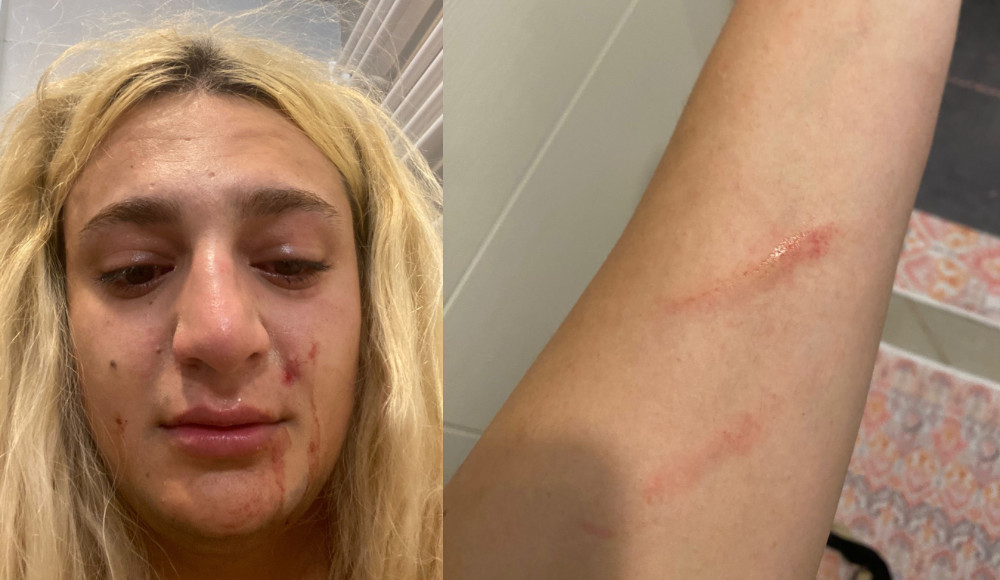 “I was subjected to hate attack and evicted from my home because of my gender identity” Kaos GL - News Portal for LGBTI+