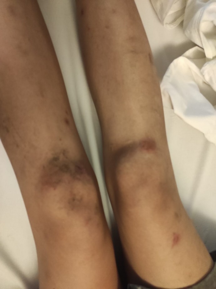 ankara-onur-yuruyusu-nde-siddet-goren-gazeteciler-iktidar-her-sene-dozunu-arttirdigi-bir-savas-ilan-etti-3