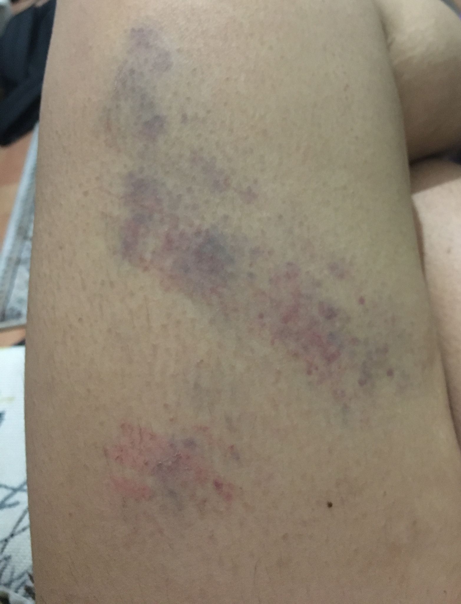 ankara-onur-yuruyusu-nden-polis-siddeti-goruntuleri-2 ankara-onur-yuruyusu-nden-polis-siddeti-goruntuleri-2