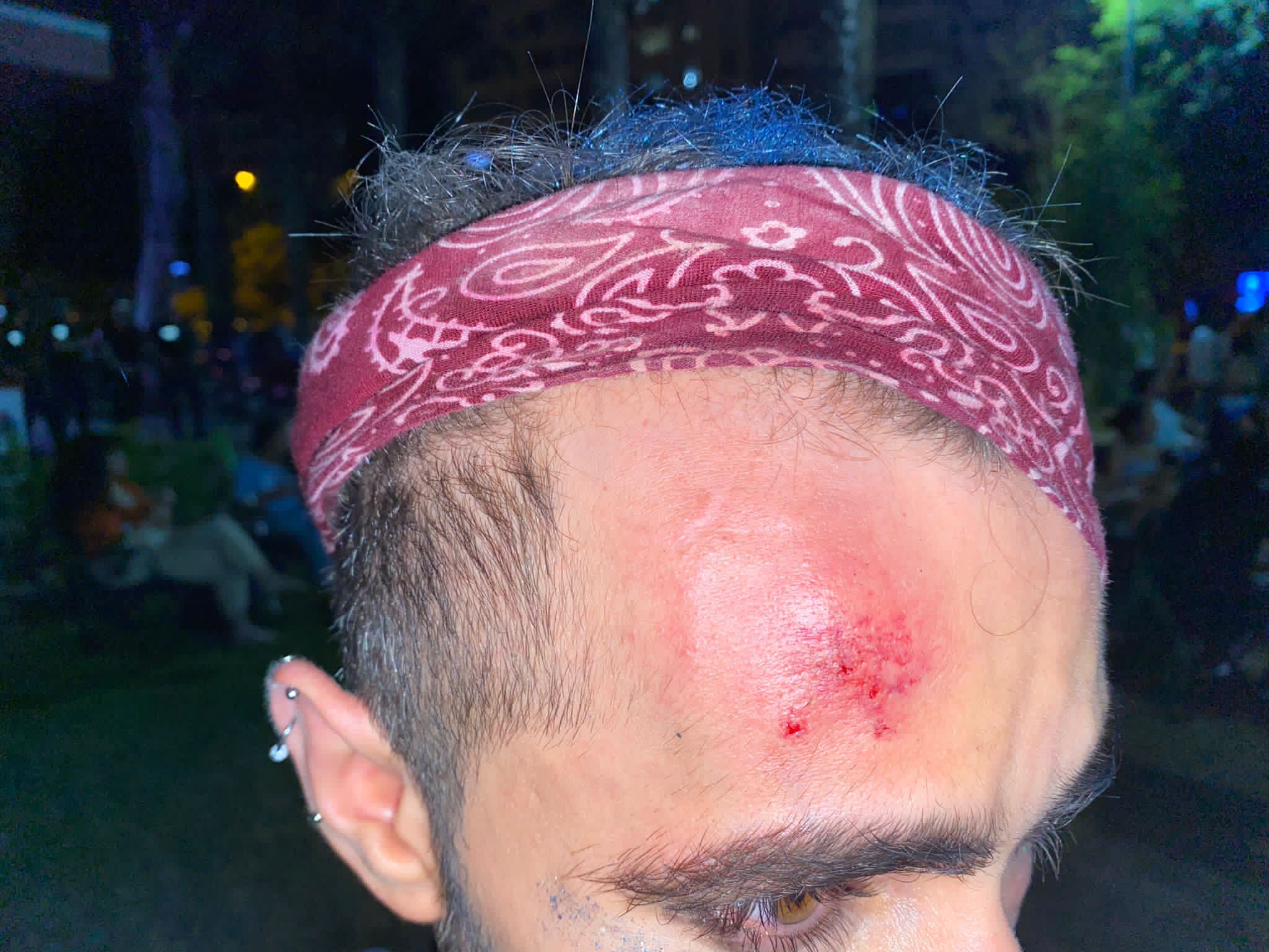 mersin-akdeniz-rap-festivalinde-homofobik-saldiri-1 mersin-akdeniz-rap-festivalinde-homofobik-saldiri-1