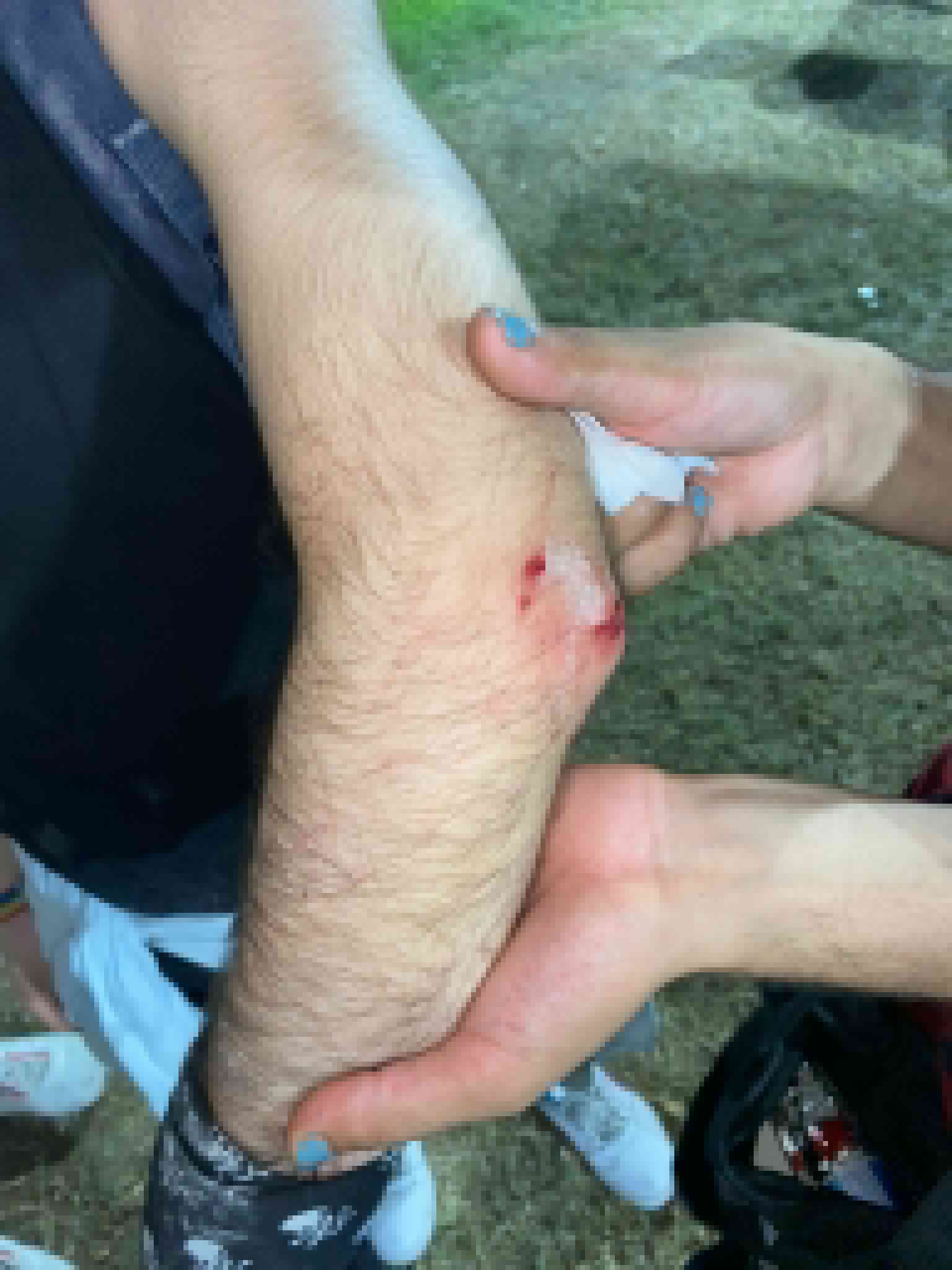 mersin-akdeniz-rap-festivalinde-homofobik-saldiri-2 mersin-akdeniz-rap-festivalinde-homofobik-saldiri-2