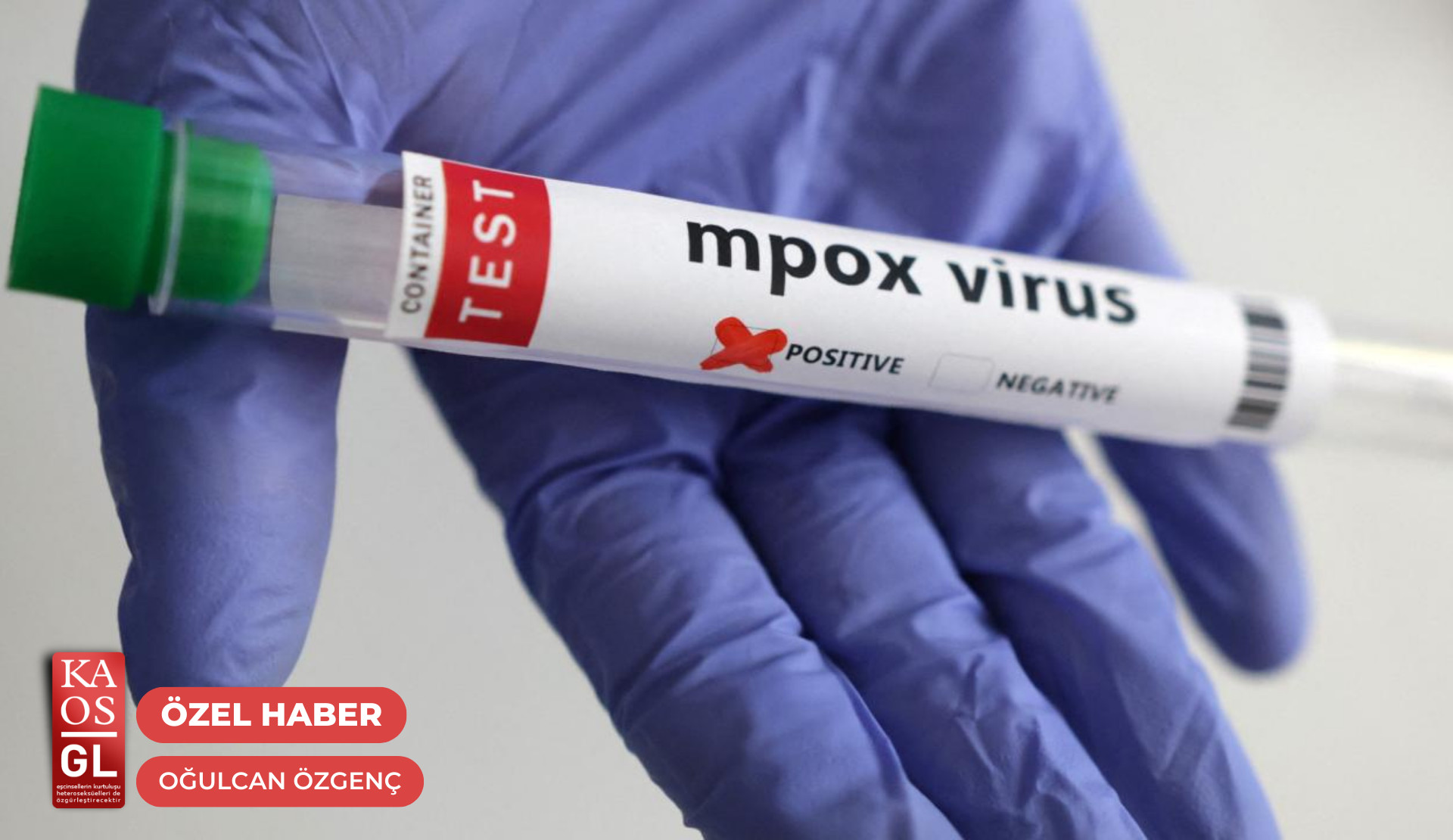 “İnsanları enfeksiyon hastalıklarıyla damgalama öteden beri bir sorun” | Kaos GL - LGBTİ+ Haber Portalı Haber