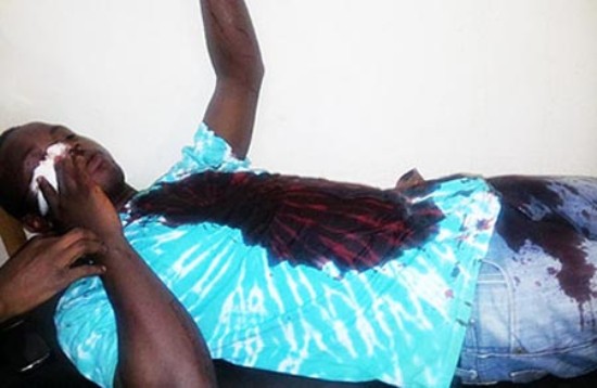 Uganda&rsquo;da LGBTİ aktivistine saldırı! | Kaos GL - LGBTİ+ Haber Portalı Haber