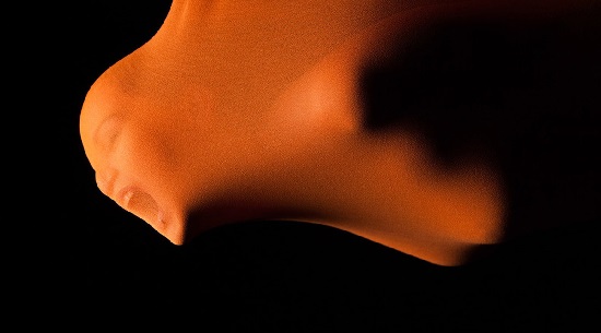 Neyse, portakal zaten turuncudur Kaos GL - LGBTİ+ Haber Portalı