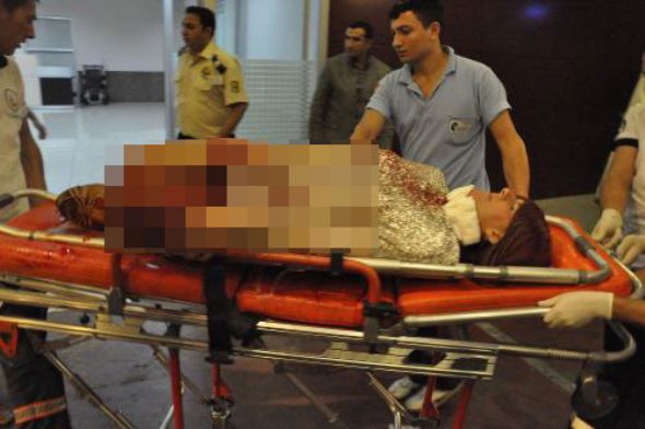 Trans Seks İşçisi İstanbul&rsquo;da Bıçaklı Saldırıya Uğradı | Kaos GL - LGBTİ+ Haber Portalı Haber