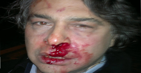 Barbaros Şansal Saldırıya Uğradı Kaos GL - LGBTİ+ Haber Portalı