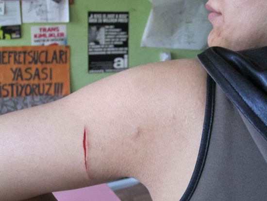 Maltepe’deki Transfobik Saldırılar Protesto Edilecek Kaos GL - LGBTİ+ Haber Portalı