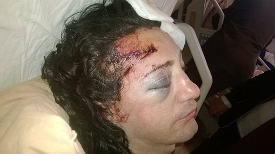 Mersin’de Transfobik Nefret Saldırısı Kaos GL - LGBTİ+ Haber Portalı