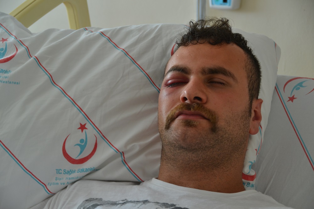 Vali yaralı yok dedi, Sinan tek gözünü kaybedebilir! | Kaos GL - LGBTİ+ Haber Portalı Haber