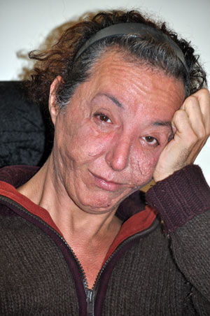 Translara Karakol Önünde Dayak | Kaos GL - LGBTİ+ Haber Portalı Haber