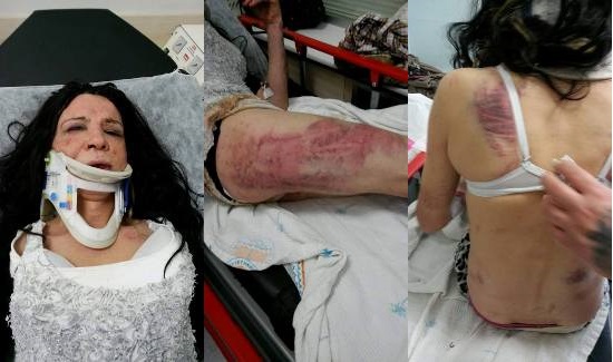 ‘Sizin gibileri işkenceyle öldürmek lazım’ diyerek saldırmışlar! Kaos GL - LGBTİ+ Haber Portalı