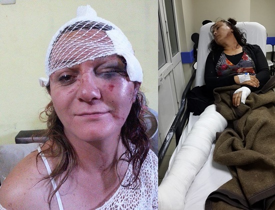 Mersin ve İstanbul&rsquo;da transfobik saldırılar | Kaos GL - LGBTİ+ Haber Portalı Haber