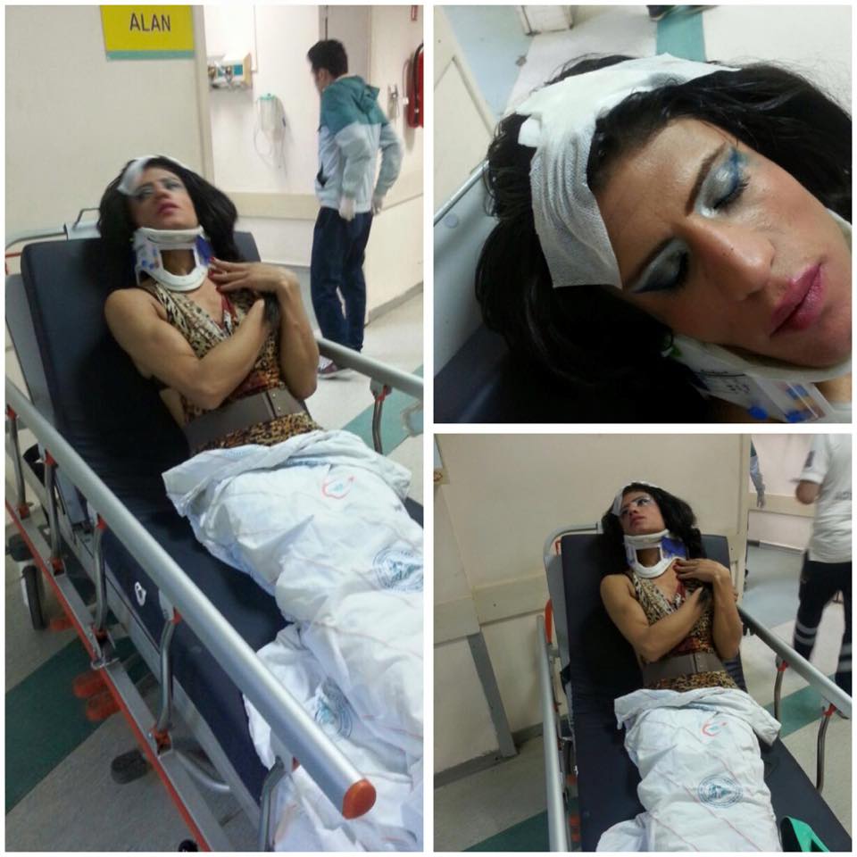 İstanbul&rsquo;da iki trans kadın daha saldırıya uğradı! | Kaos GL - LGBTİ+ Haber Portalı Haber