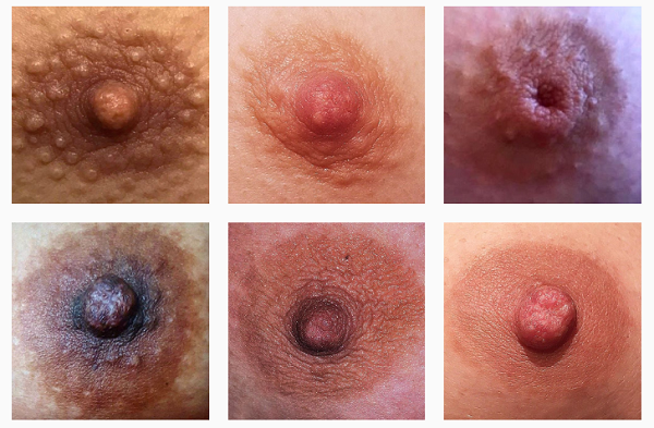 İnstagram sansürüne karşı: Cinsiyetsiz meme uçları | Kaos GL - LGBTİ+ Haber Portalı Haber