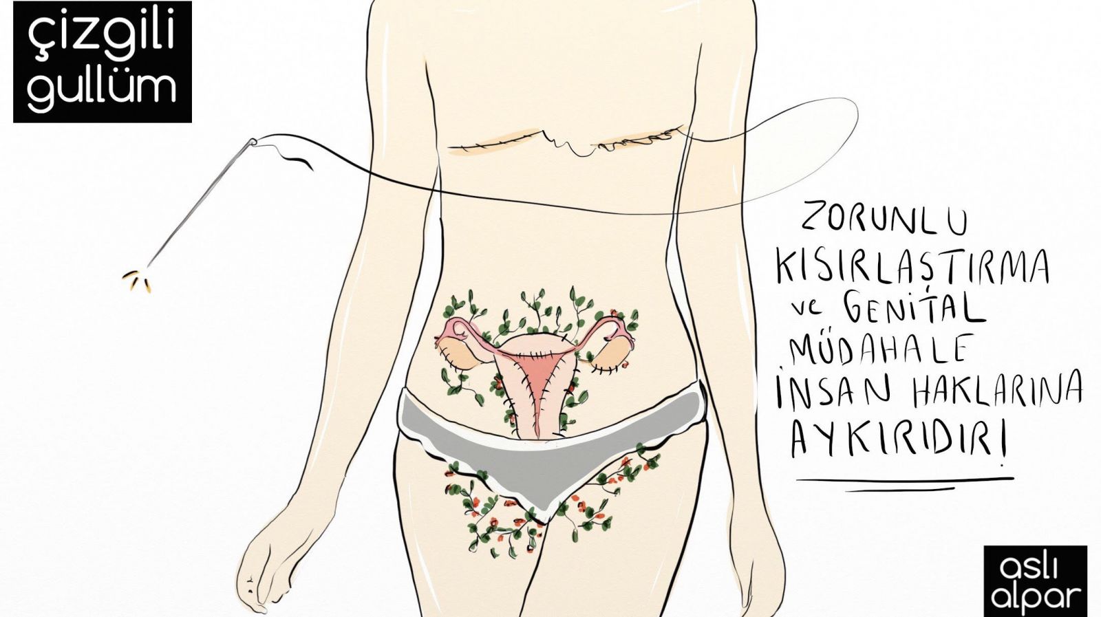 Çizgili Gullüm: Cinsiyet geçiş sürecinde transların insan hakları ihlal ediliyor! | Kaos GL - LGBTİ+ Haber Portalı Haber