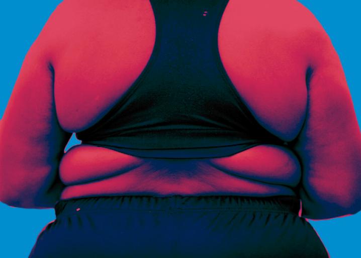 ‘Şişman olduğun için’ ve doktorlarımın söylediği diğer yalanlar Kaos GL - LGBTİ+ Haber Portalı